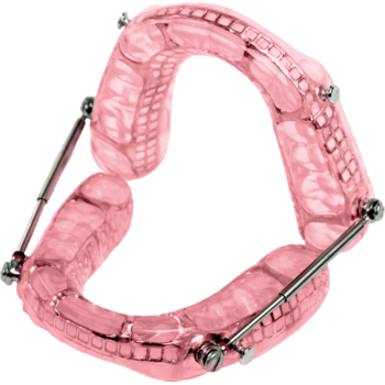 somnodent oral appliance