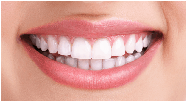 Teeth Whitening Treatment at Apollo Dental